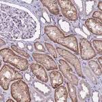Merck Anti-ALG3 antibody produced in rabbit