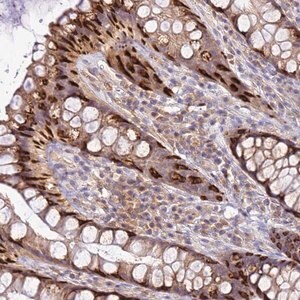 Merck Anti-ADPGK antibody produced in rabbit