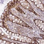 Merck Anti-ADPGK antibody produced in rabbit