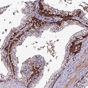 Merck Anti-DDX19A antibody produced in rabbit