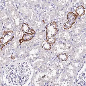 Merck Anti-TRMT44 antibody produced in rabbit
