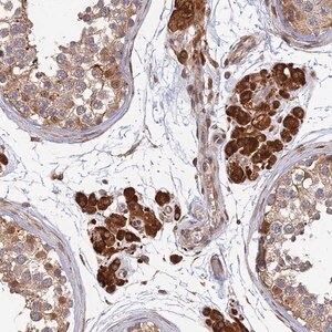 Merck Anti-OR14J1 antibody produced in rabbit