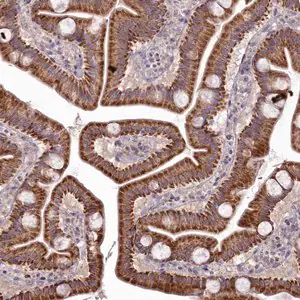 Merck Anti-MICU2 antibody produced in rabbit
