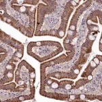 Merck Anti-MICU2 antibody produced in rabbit