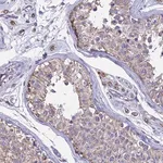Merck Anti-OR2W3 antibody produced in rabbit