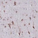 Merck Anti-CERS1 antibody produced in rabbit