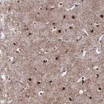 Merck Anti-RAVER2 antibody produced in rabbit