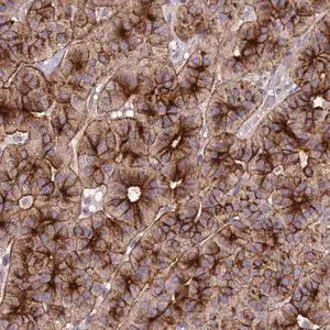 Merck Anti-C11orf68 antibody produced in rabbit