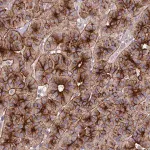 Merck Anti-C11orf68 antibody produced in rabbit