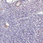 Merck Anti-JRKL antibody produced in rabbit