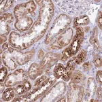 Merck Anti-PNLIPRP3 antibody produced in rabbit