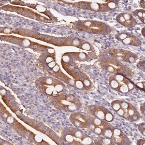 Merck Anti-CNOT9 antibody produced in rabbit