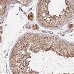 Merck Anti-ABCB6 antibody produced in rabbit
