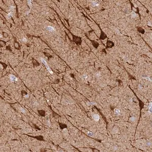 Merck Anti-MCCD1 antibody produced in rabbit