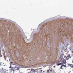 Merck Anti-ACVR2A antibody produced in rabbit