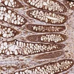 Merck Anti-PIH1D1 antibody produced in rabbit