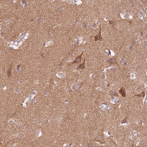 Merck Anti-PROKR2 antibody produced in rabbit