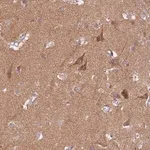 Merck Anti-PROKR2 antibody produced in rabbit