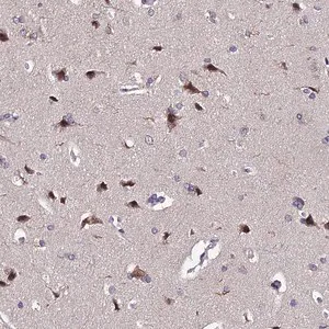 Merck Anti-INPP4A antibody produced in rabbit