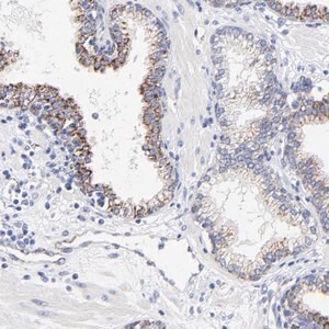 Merck Anti-FBXO10 antibody produced in rabbit