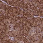 Merck Anti-ARHGAP18 antibody produced in rabbit