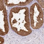Merck Anti-WDR92 antibody produced in rabbit