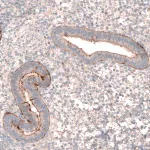 Merck Anti-LRRC15 antibody produced in rabbit