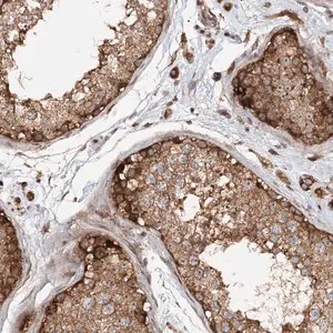 Merck Anti-RNF111 antibody produced in rabbit