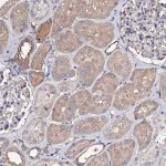Merck Anti-TCAF2 antibody produced in rabbit