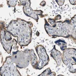 Merck Anti-STARD13 antibody produced in rabbit