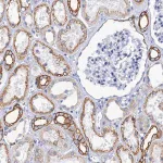 Merck Anti-RAB3IP antibody produced in rabbit