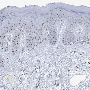 Merck Anti-NOP2 antibody produced in rabbit