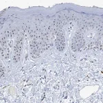 Merck Anti-NOP2 antibody produced in rabbit