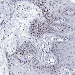 Merck Anti-NUDT13 antibody produced in rabbit