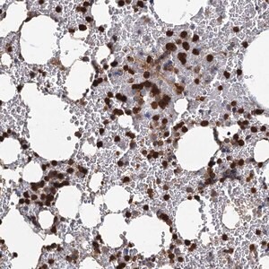 Merck Anti-ANKDD1A antibody produced in rabbit