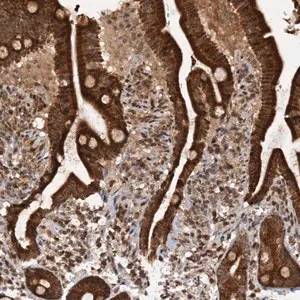 Merck Anti-REP15 antibody produced in rabbit