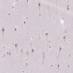 Merck Anti-UTP4 antibody produced in rabbit