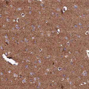 Merck Anti-UBE3B antibody produced in rabbit