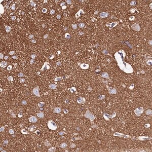 Merck Anti-FXYD6 antibody produced in rabbit