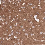 Merck Anti-FXYD6 antibody produced in rabbit