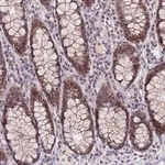 Merck Anti-NSMCE1 antibody produced in rabbit