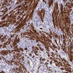 Merck Anti-CLIP4 antibody produced in rabbit