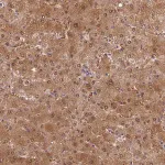 Merck Anti-SLC25A41 antibody produced in rabbit