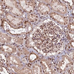 Merck Anti-GPATCH1 antibody produced in rabbit