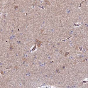 Merck Anti-CLVS2 antibody produced in rabbit