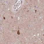 Merck Anti-RHBDL2 antibody produced in rabbit