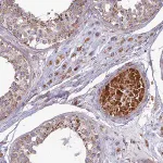 Merck Anti-SLC35F4 antibody produced in rabbit