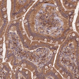 Merck Anti-TRIM40 antibody produced in rabbit
