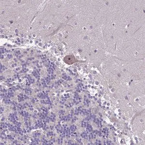 Merck Anti-ZNF333 antibody produced in rabbit