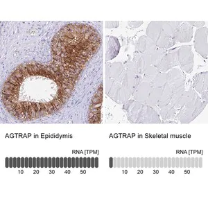 Merck Anti-AGTRAP antibody produced in rabbit